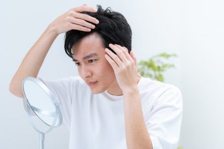薄毛に悩む若い男性