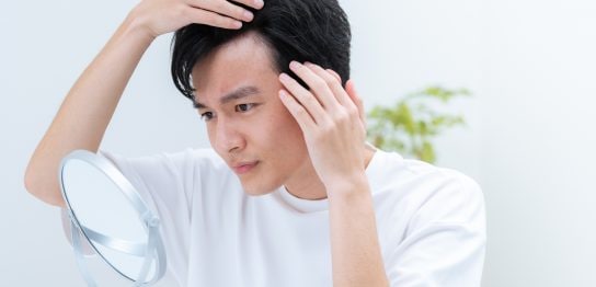 薄毛に悩む若い男性