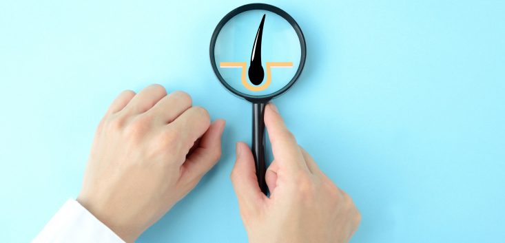 SBCおすすめのAGA治療4選！後悔しないAGAクリニックを選ぶには？編集