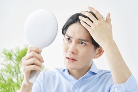 薄毛に悩む男性