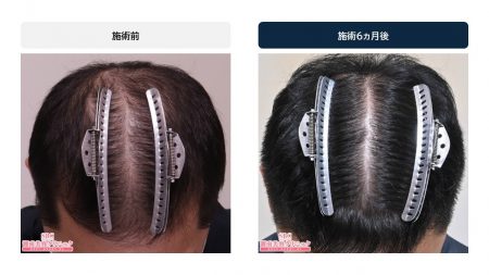 症例のビフォーアフター