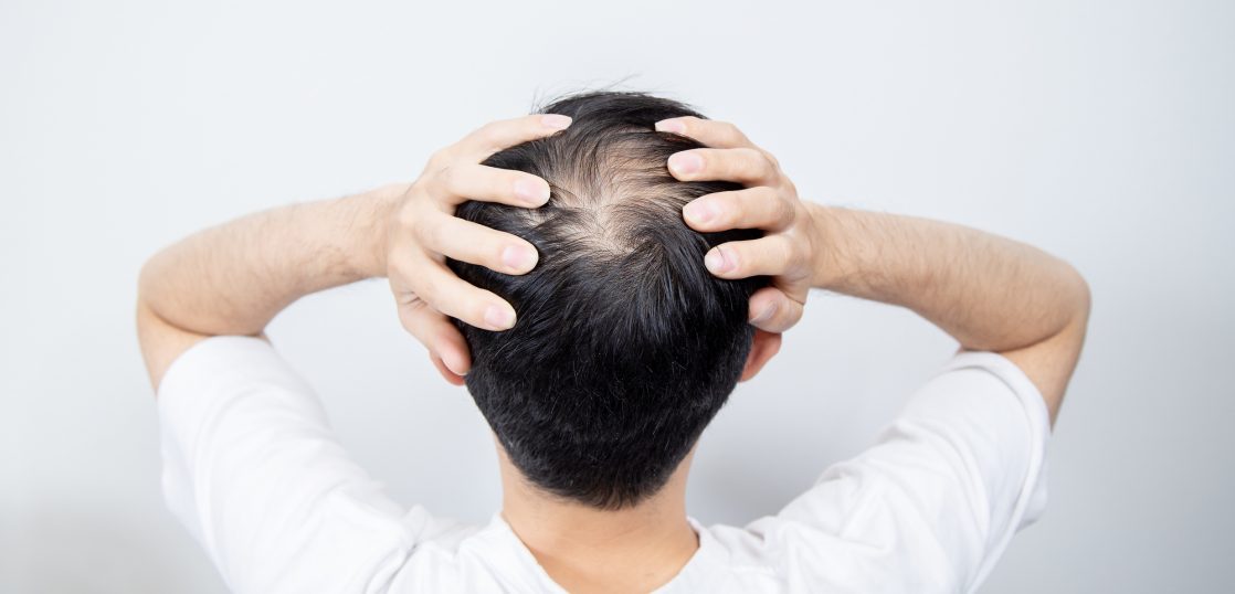 男性薄毛治療に関する疑問に答えるAGA(薄毛)治療ブログ|【公式】湘南AGAクリニック