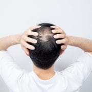 つむじに悩む男性
