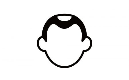 O字ハゲのイラスト