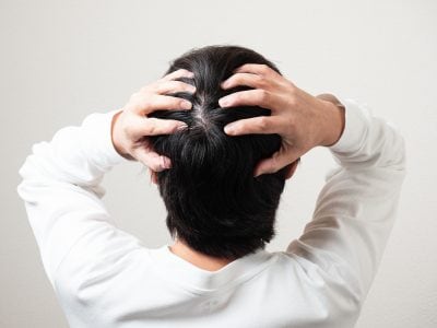 男性のつむじ割れ