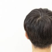 男性のつむじ