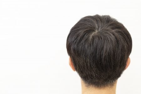 男性のつむじ
