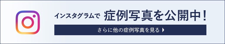 インスタグラムで症例写真を公開中!