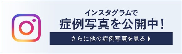 インスタグラムで症例写真を公開中