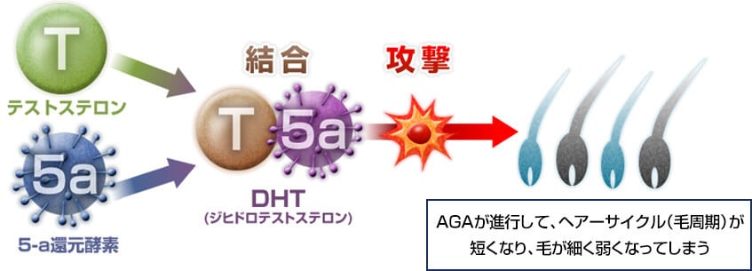 AGA進行の仕組み