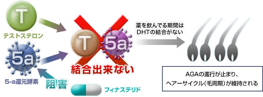 従来のAGA治療法