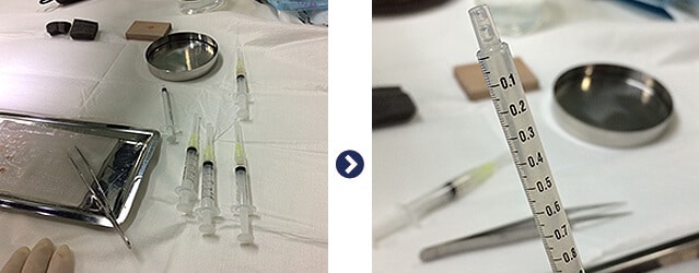 採取した毛包組織を細かく粉砕し、それを溶かした液体を頭皮に注入していきます。