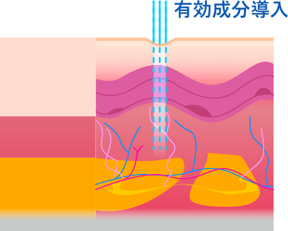有効成分導入