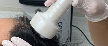 イオン導入