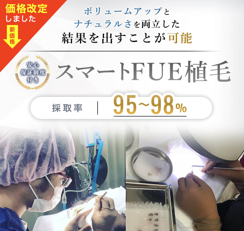 スマートFUE法