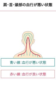 首・肩・頭部の血行が悪い状態