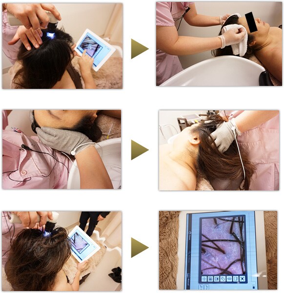 ヘアーメディックの様子 イメージ