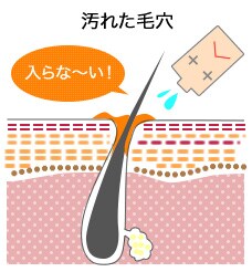 汚れた毛穴