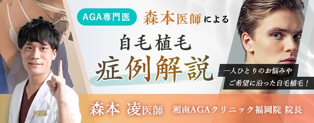 森本医師による自毛植毛症例解説
