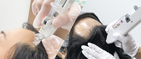 ジェットメソ