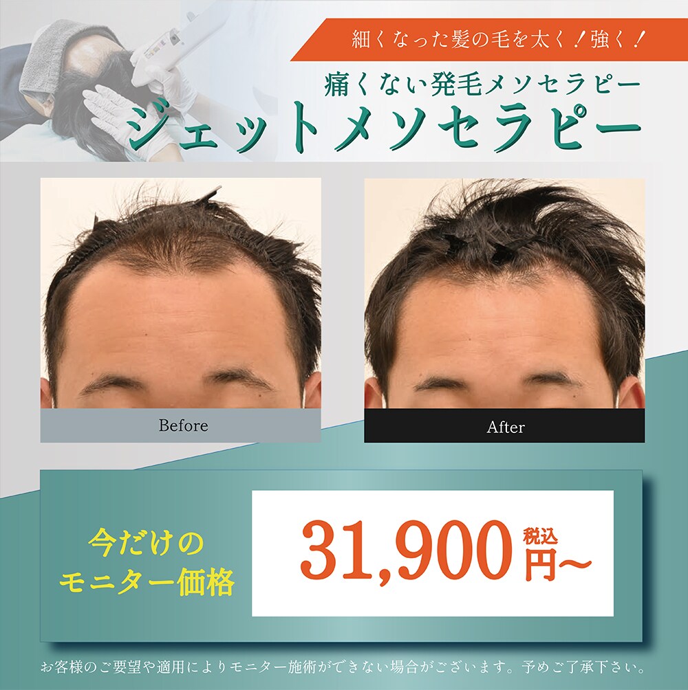 ジェットメソセラピーモニター