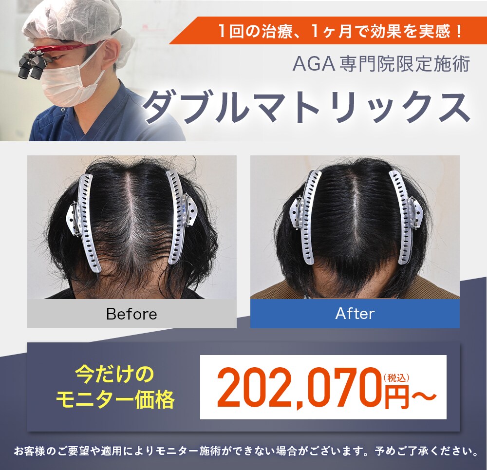 ダブルマトリックスモニター募集