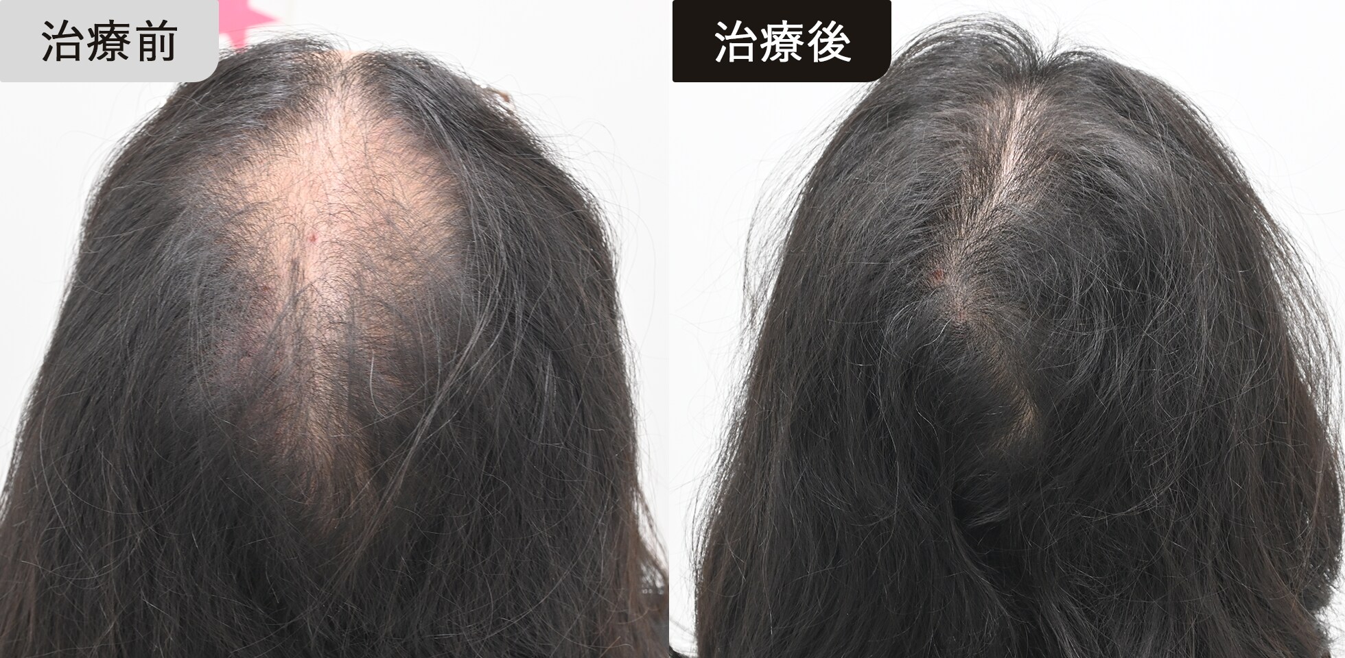 症例写真