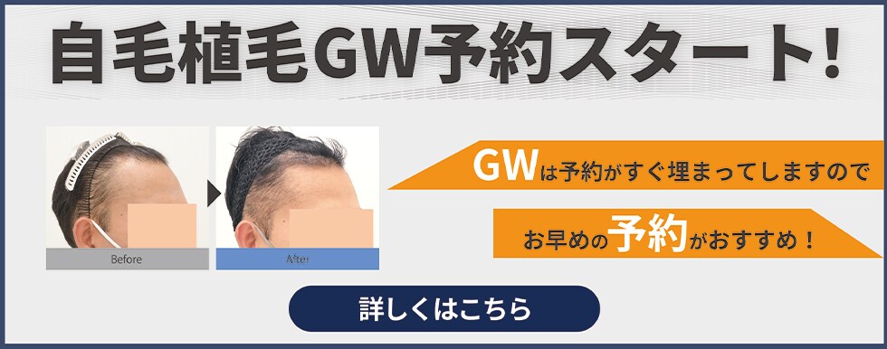 自毛植毛GW予約スタート！