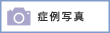 症例写真