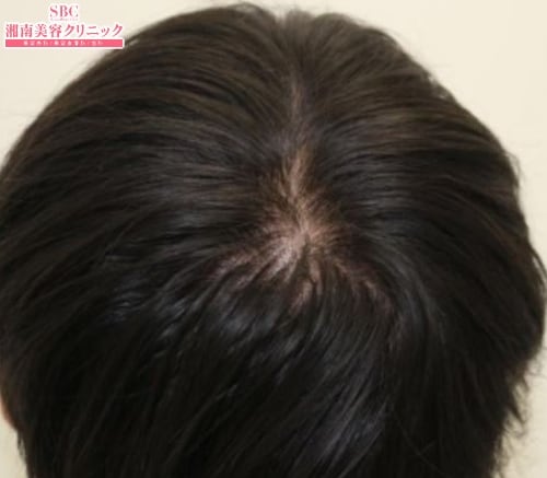 術前