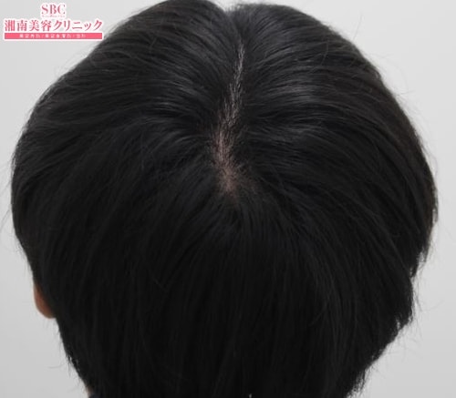 治療開始後6ヶ月