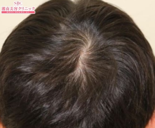 術前