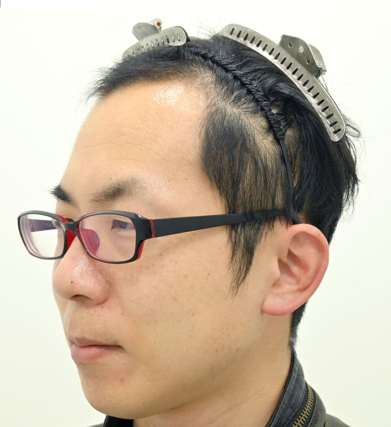 術前