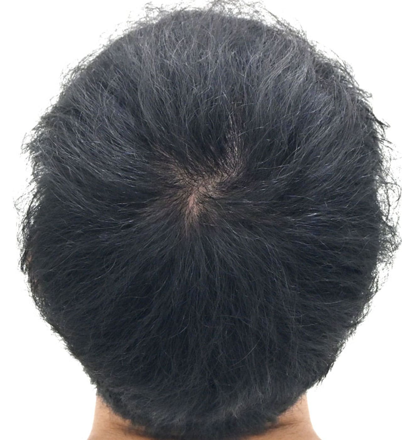 治療開始9ヶ月後