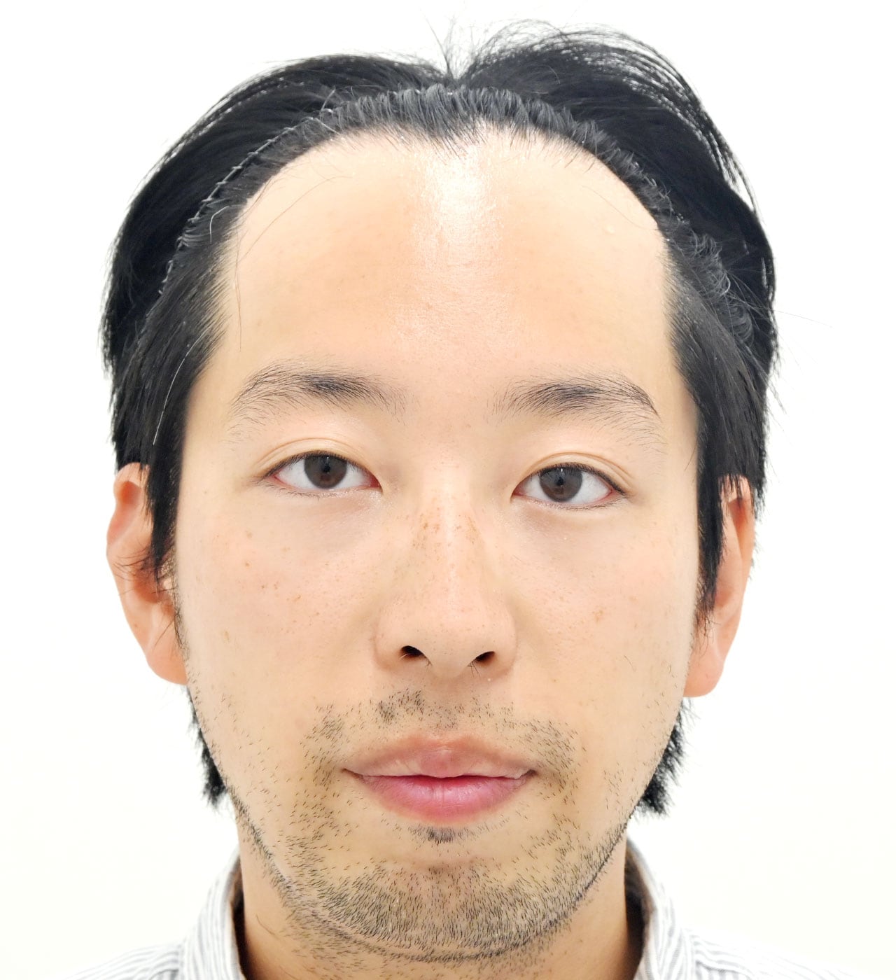 術前