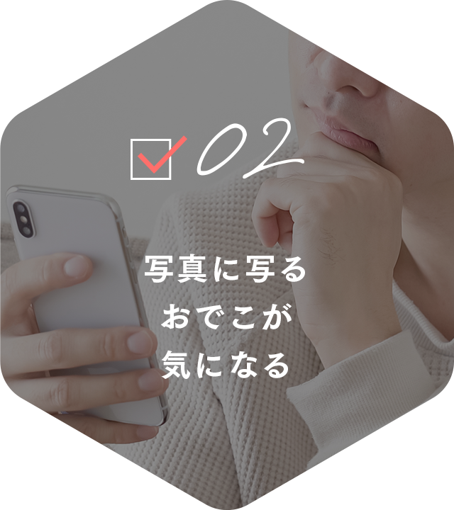 02 写真に映るおでこが気になる