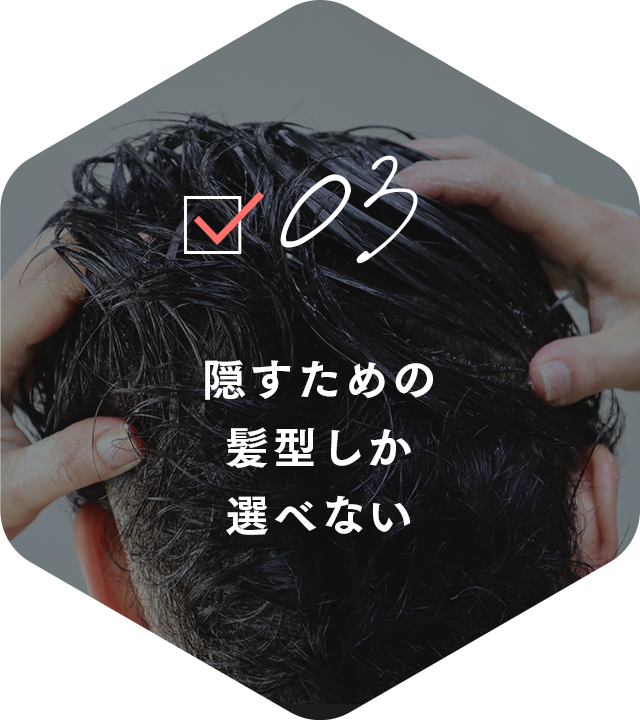 03 隠すための髪型しか選べない