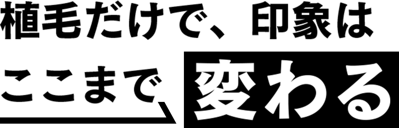植毛だけで、印象はここまで変わる
