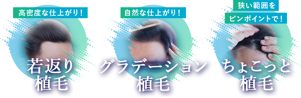 若返り植毛 グラデーション植毛 ちょこっと植毛