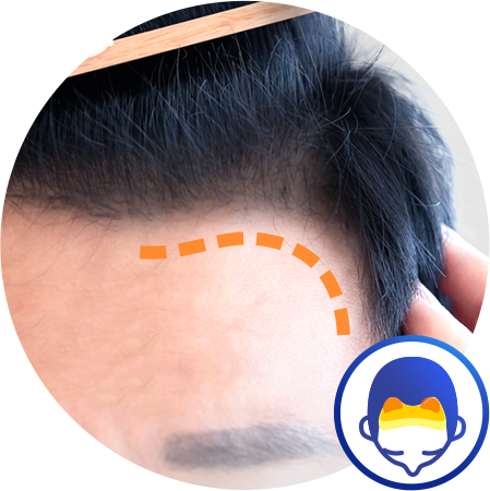 グラデーション植毛