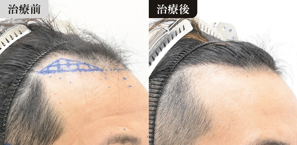 症例写真