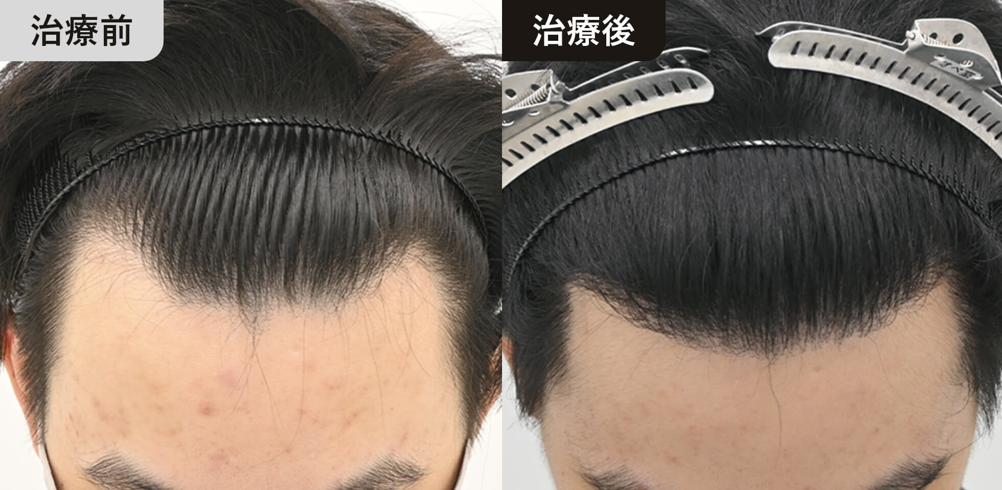症例写真