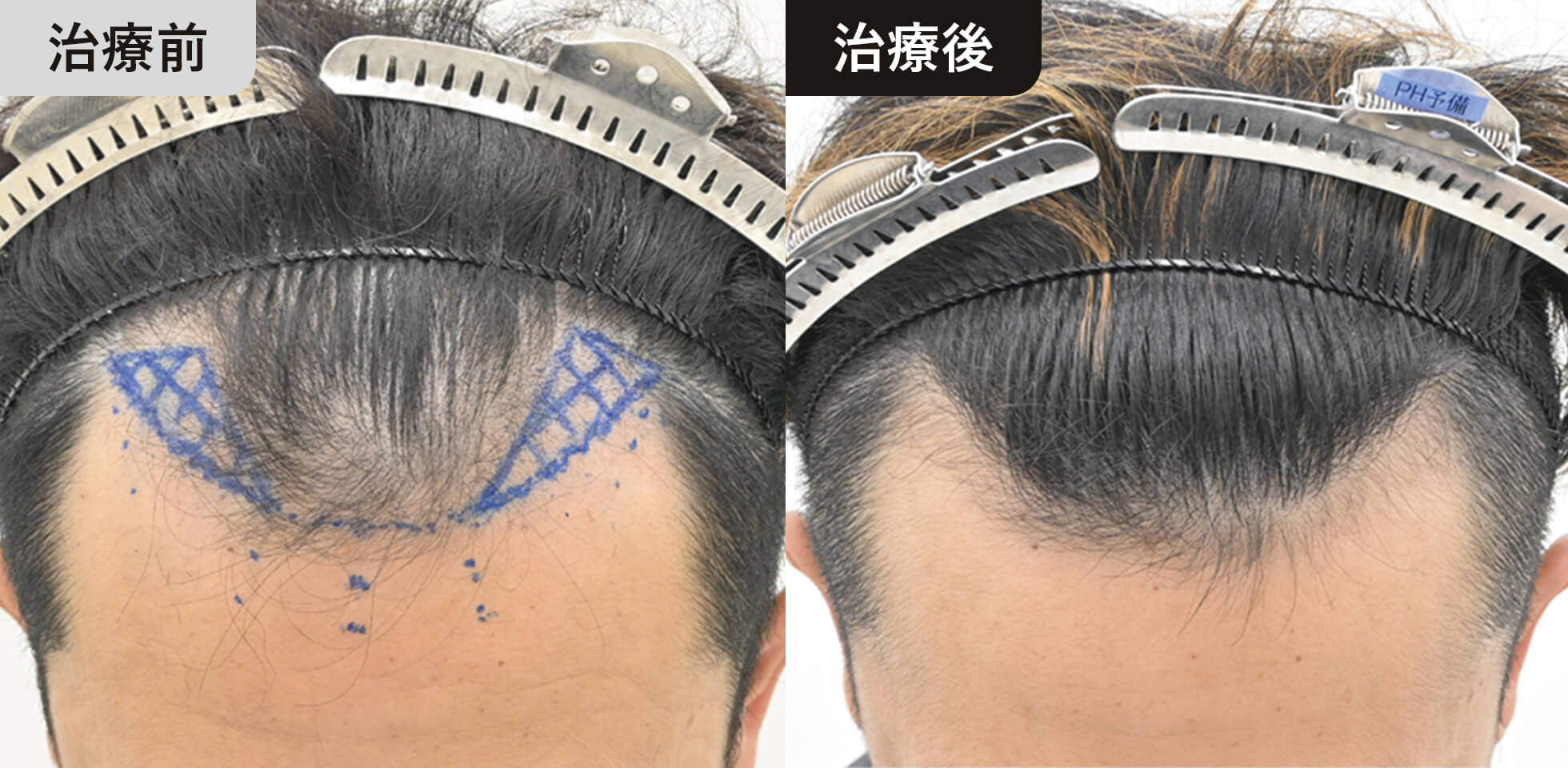 症例写真