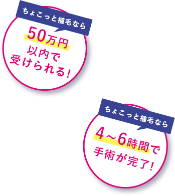 ちょこっと植毛なら