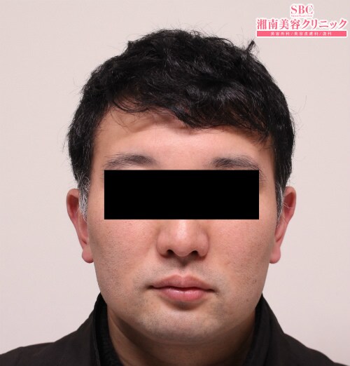 治療開始後12ヶ月