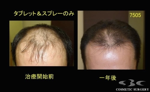 術前
