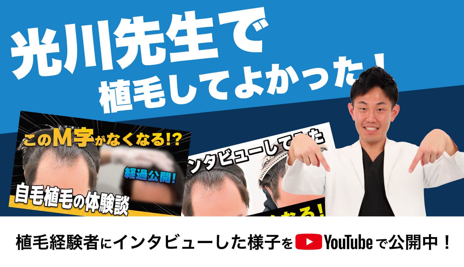 光川先生で植毛してよかった!植毛経験者にインタビューした様子をYouTubeで公開中!
