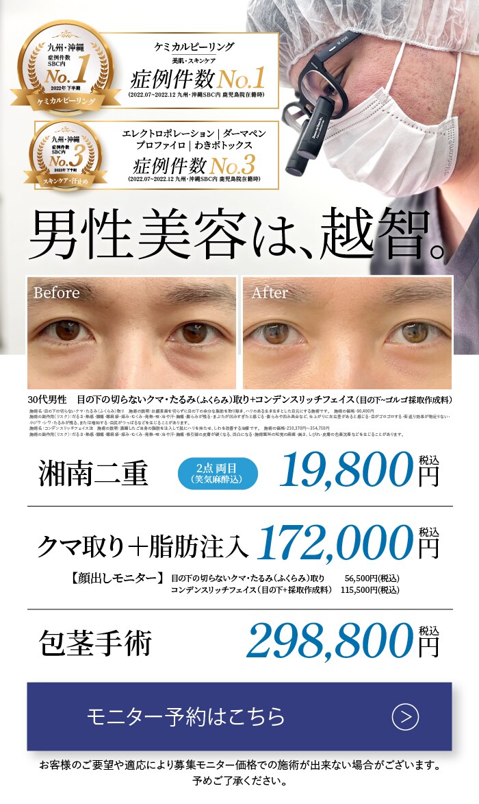 男性美容は、越智 モニター予約はこちら