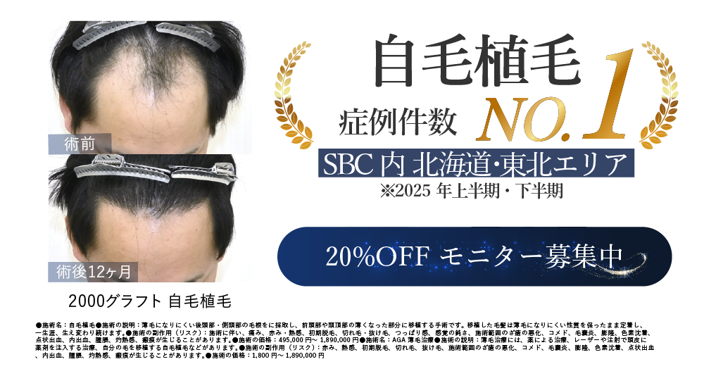 20%OFFモニター募集中