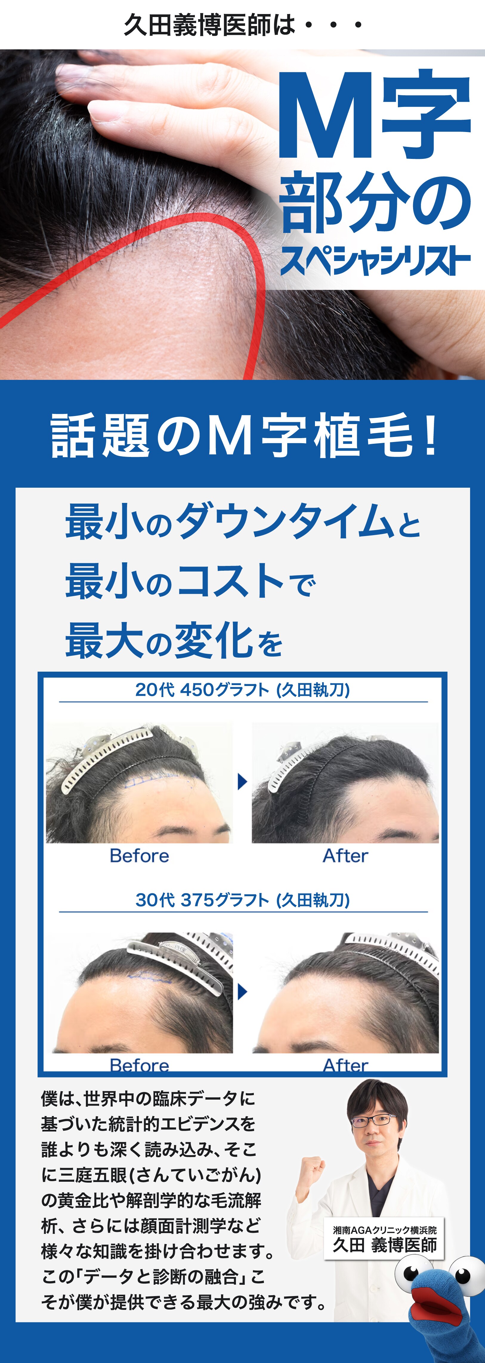 久田医師はM字のスペシャリスト